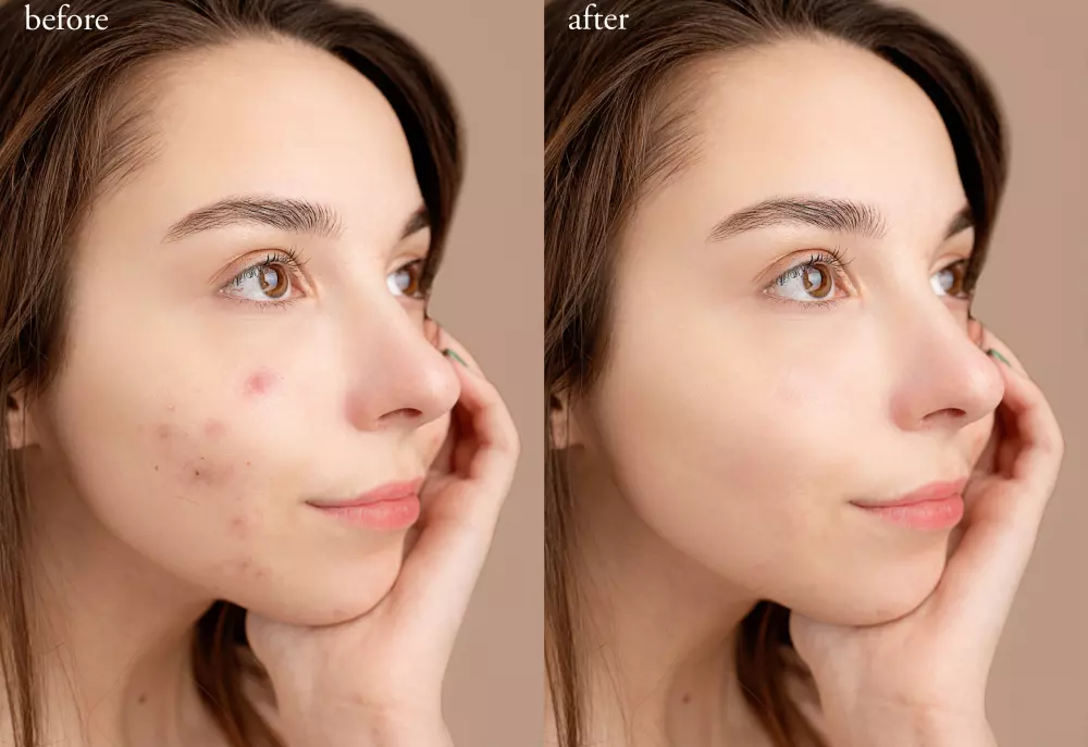 تعديل الصور