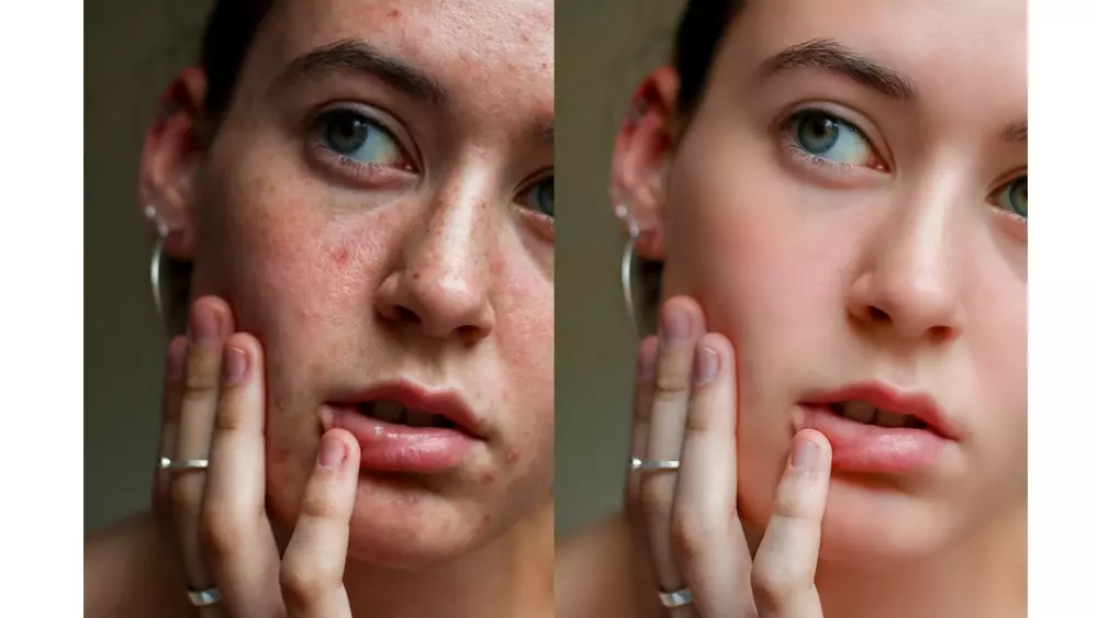 التعديل والتحسين الإحترافي على الصور