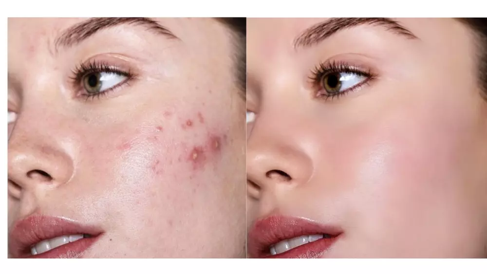 التعديل والتحسين الإحترافي على الصور