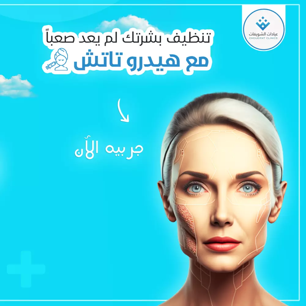 تصميم Grid إنستغرام مكون من 3 بوستات