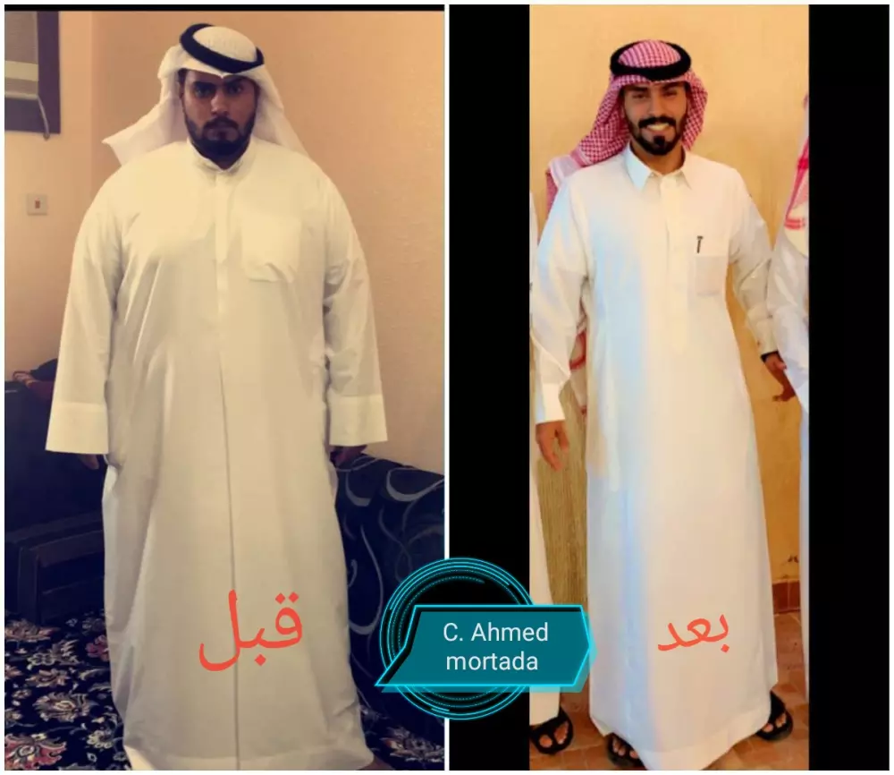 استشارات تغذوية للسمنة والنحافة