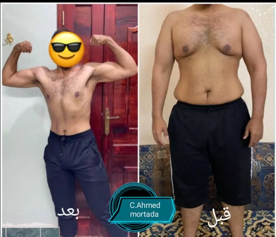 استشارات تغذوية للسمنة والنحافة