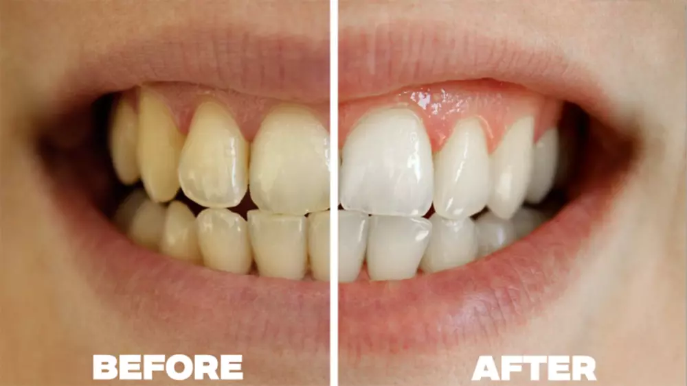 تعديل وتحسين للصور وترميمها بشكل احترافي