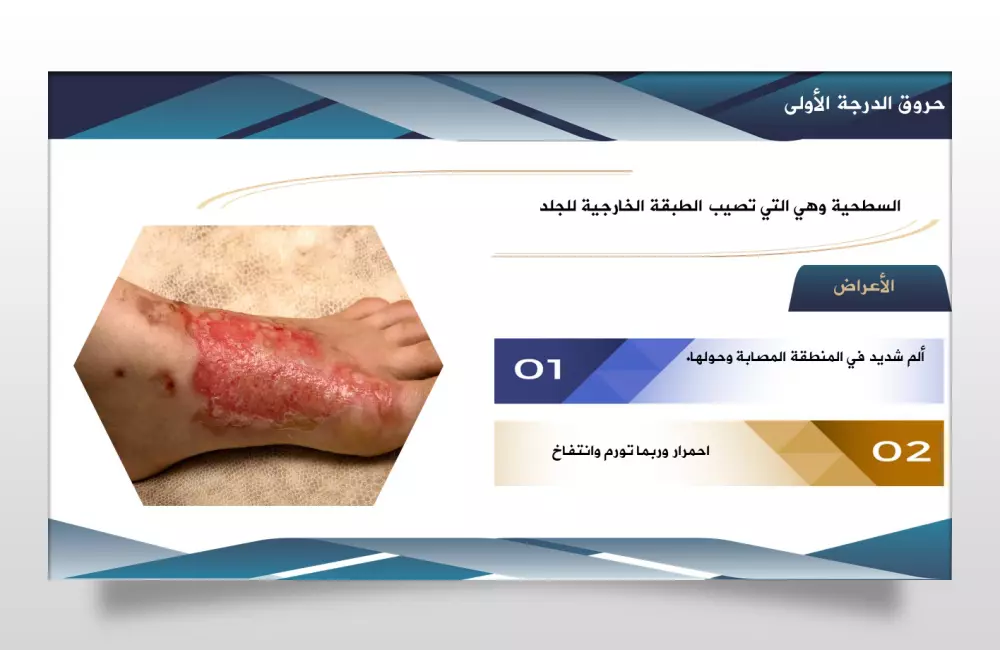 تصميم عروض تقديمية احترافية