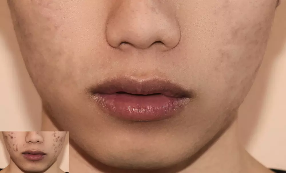 تعديل الصور