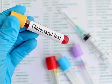 قراءة مفصلة للتحاليل الطبية