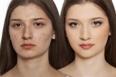 تحسين وتجميل الصور بدقة عالية (Retouching) احترافي