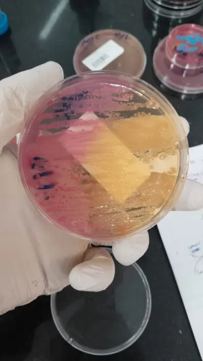 استشارات طبيه في علم تحاليل الميكروبيولوجي